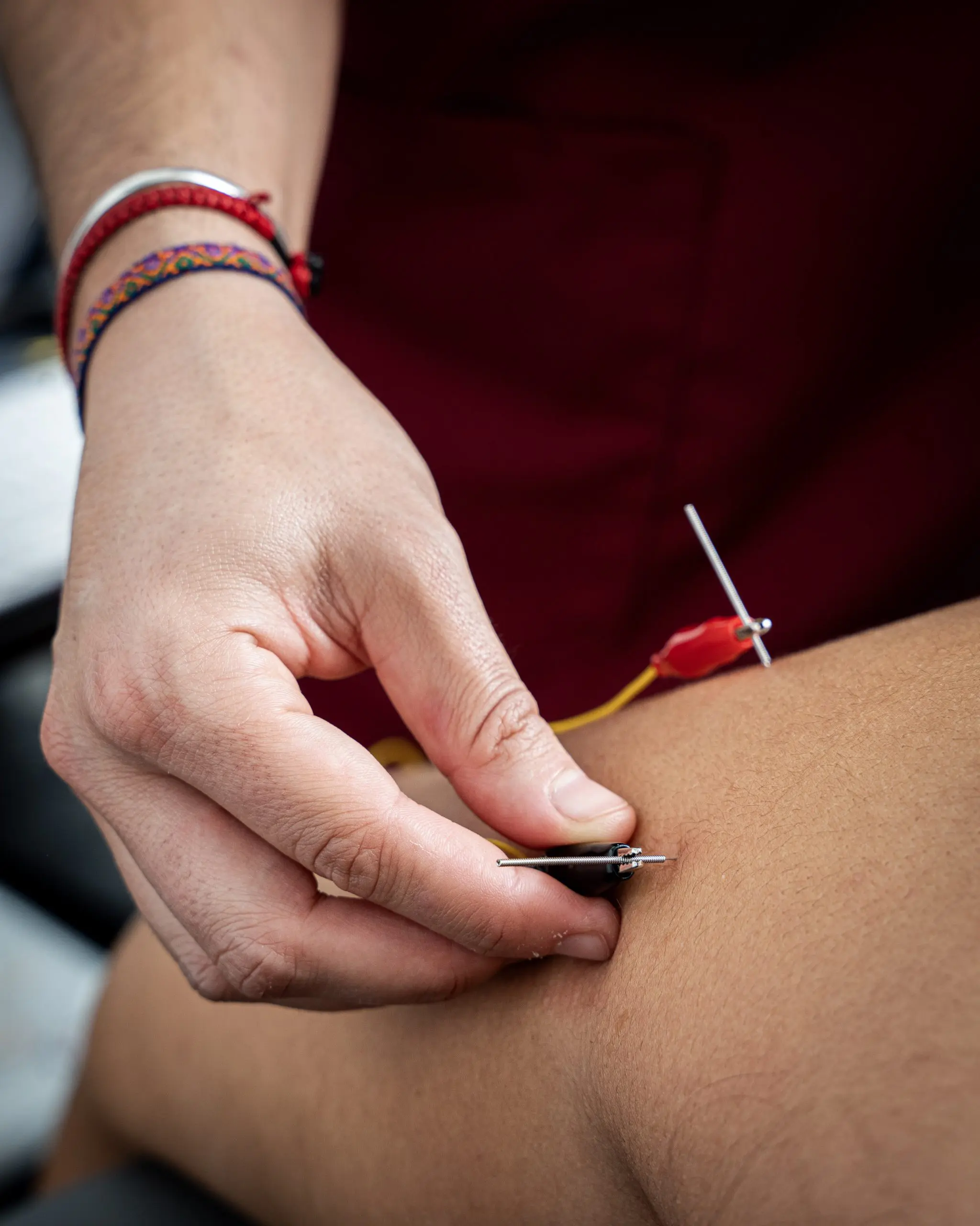 Técnicas invasivas de fisioterapia en Zutik Oñati